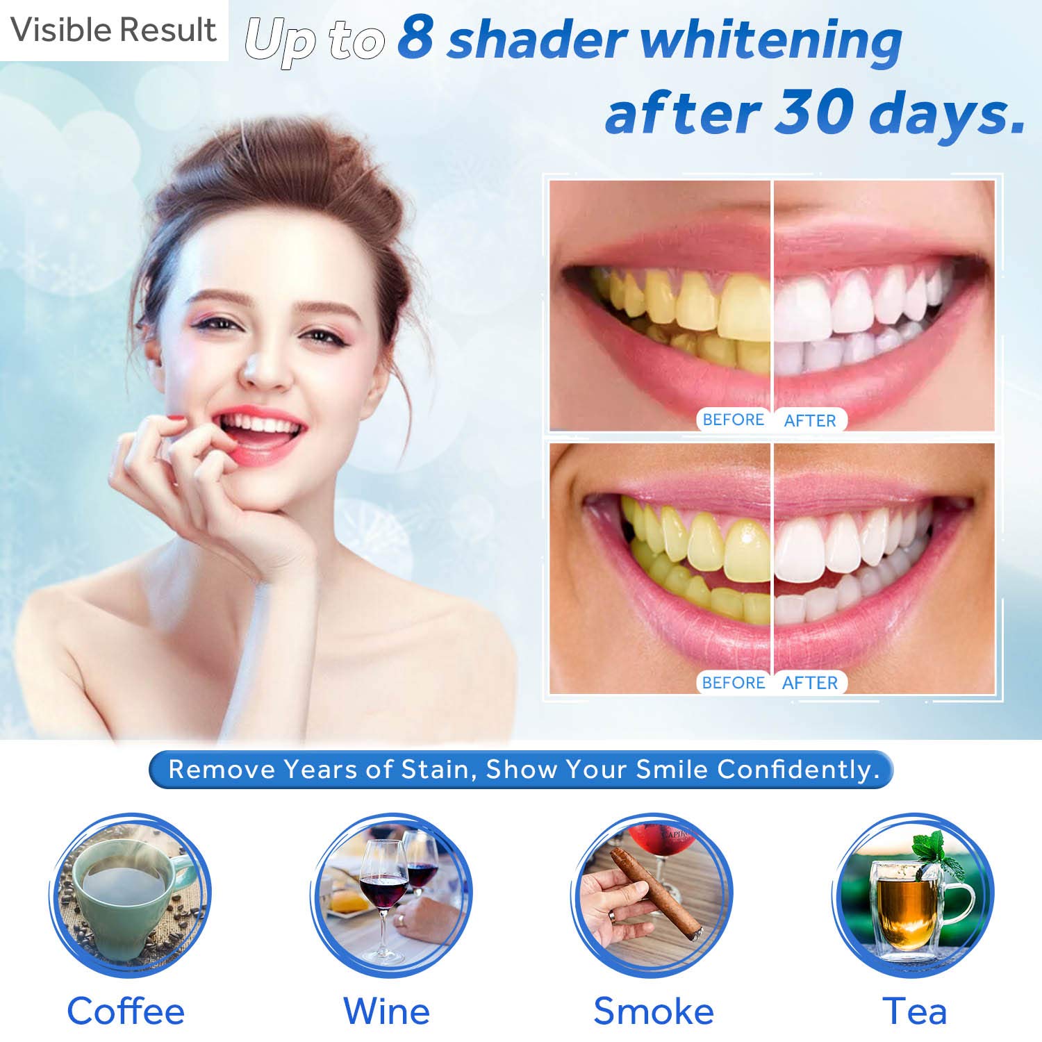 Teeth Whitening Gel Refill Syr - Teeth Whitening Mouth Guard review and price