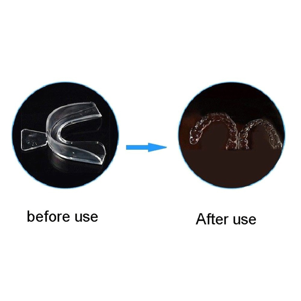 2/4pcs Soft Tooth Orthodontic  - Teeth Whitening Mouth Guard review and price