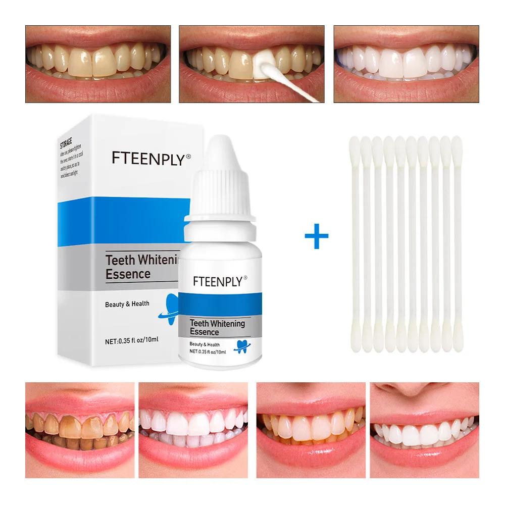 FTEENPLY Teeth Whitening Essen - Teeth Whitening Paste review and price