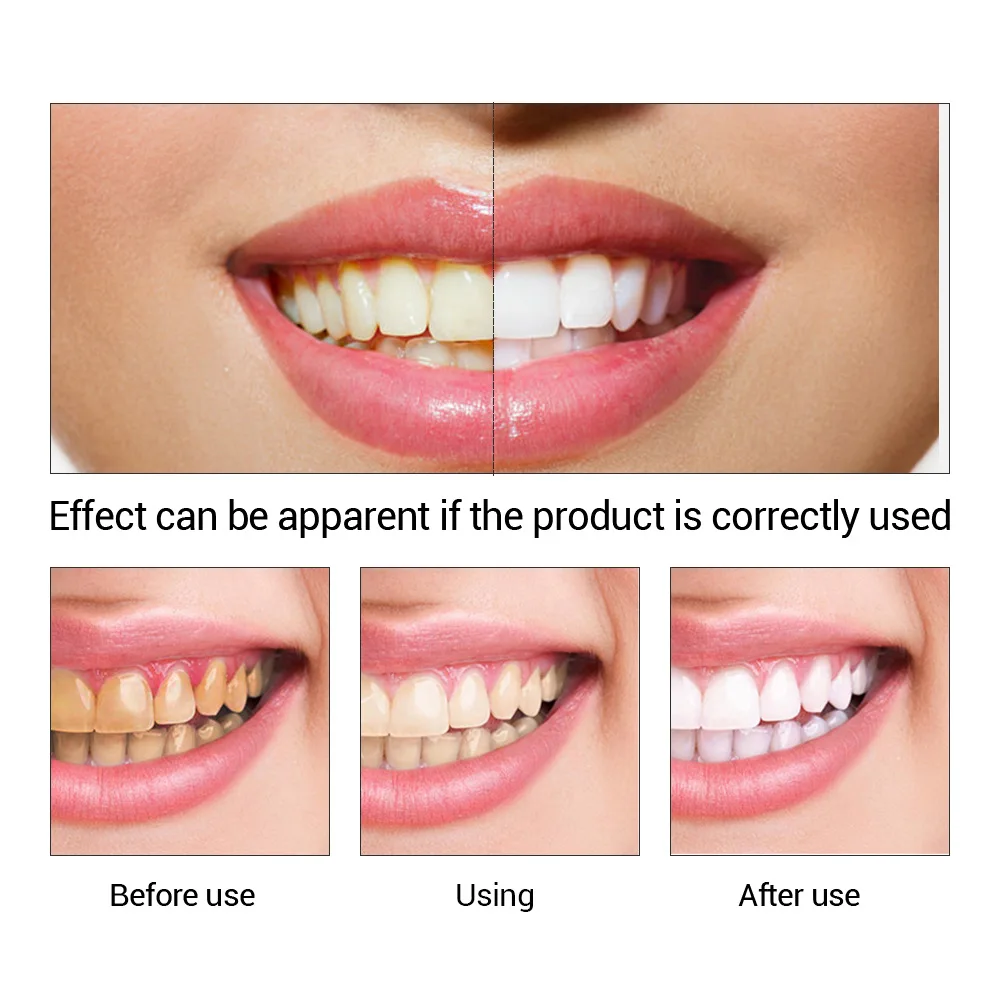 FTEENPLY Teeth Whitening Essen - Teeth Whitening Paste review and price