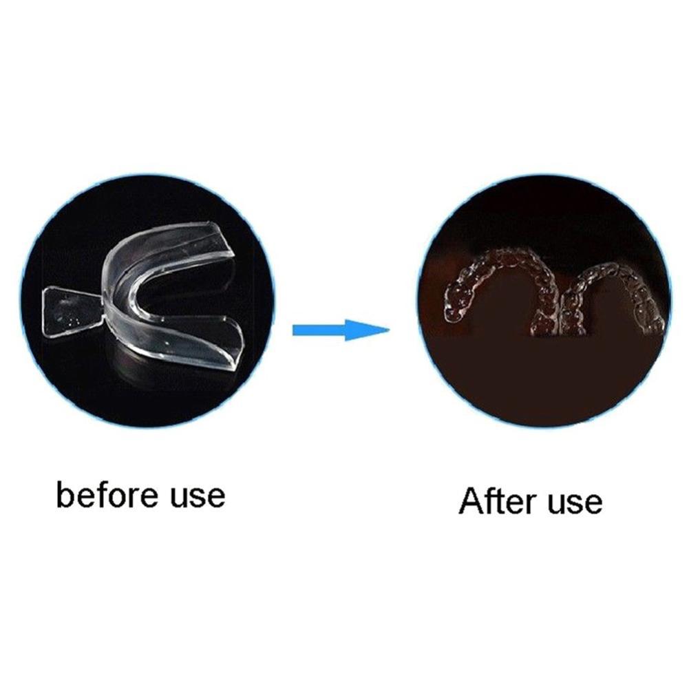 Silicone Mouth Guard Orthodont - Teeth Whitening Mouth Guard review and price