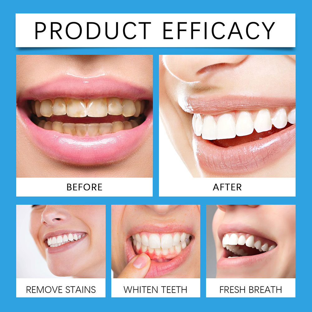 Professional Teeth Stain Remov - Teeth Whitening For Photos review and price